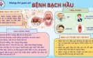 BỆNH BẠCH HẦU VÀ CÁC BIỆN PHÁP PHÒNG TRÁNH